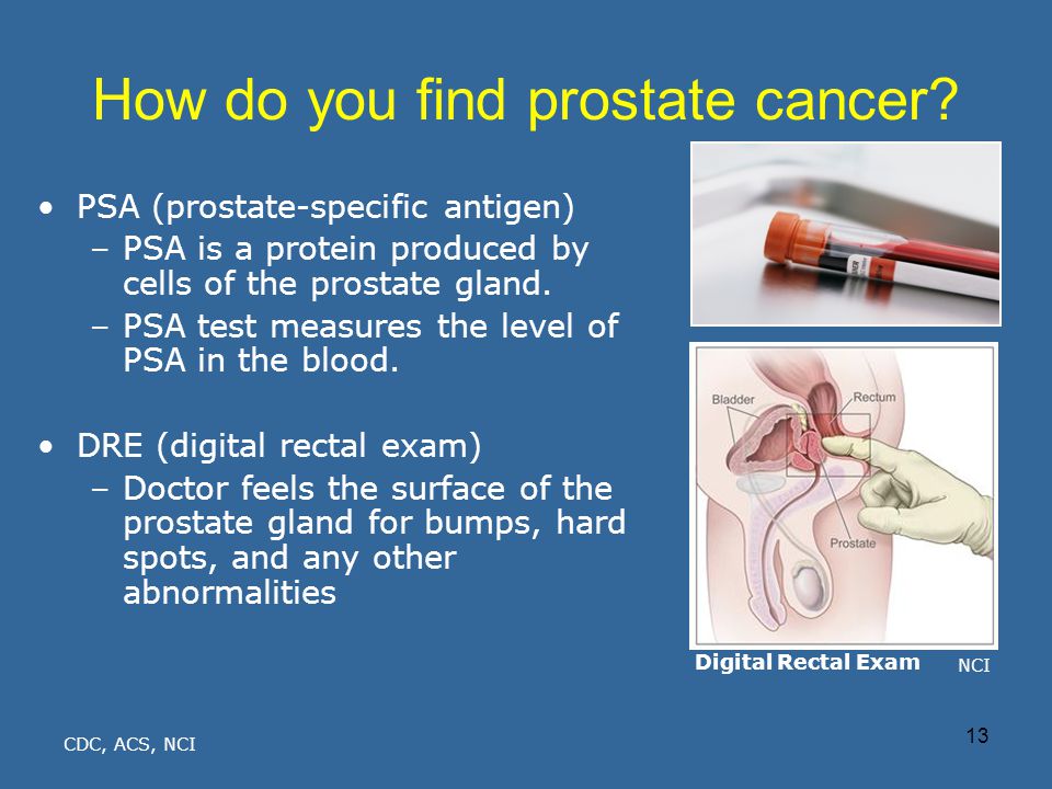 How do they check a male prostate